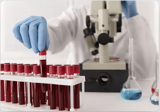 Professional Blood Testing
